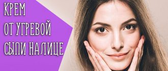 Причины появления акне на лице