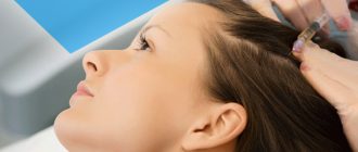 Что такое мезотерапия волос