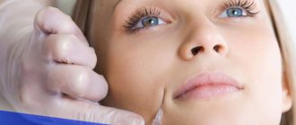 Структура кожи и ее старение