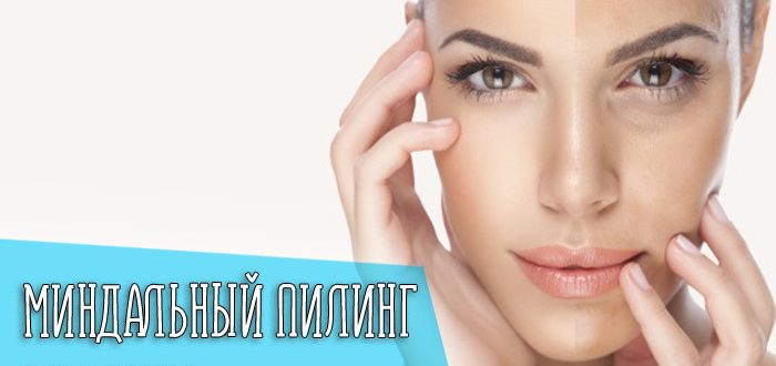 Что такое миндальный пилинг