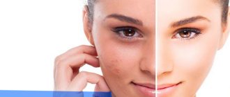 Принцип действия и эффективность