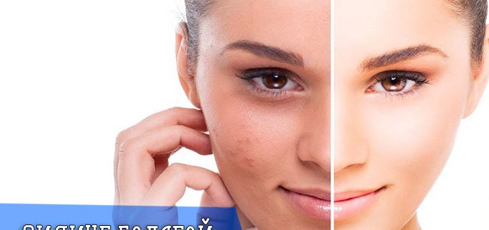 Принцип действия и эффективность