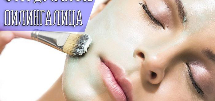 Эффективность пилинга для лица