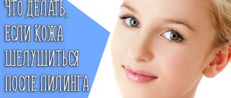Почему кожа подвергается шелушению