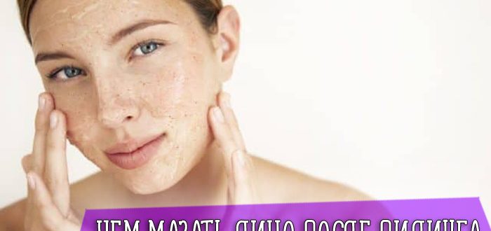 Что происходит с кожей после процедур