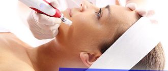 Принцип действия и эффективность