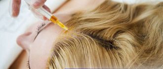 Виды и причины облысения