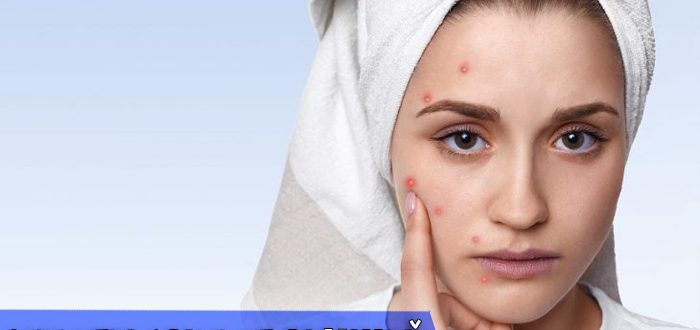 Противопоказания к применению мезотерапии от прыщей