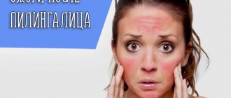 Причины появления ожога