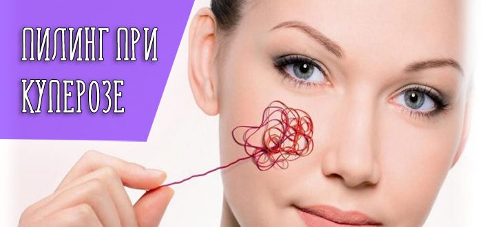 Эффективность пилинга при куперозе