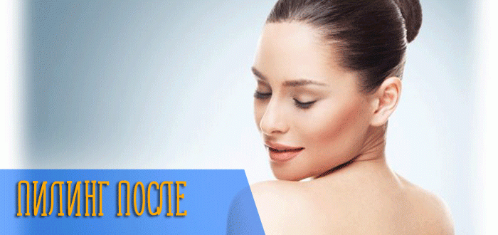 Можно ли сочетать пилинг и биоревитализацию?