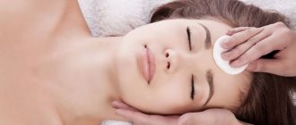 Кислотный пилинг для лица