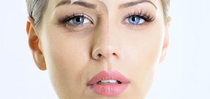 Пилинг после ботокса