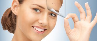 Лучшие маски для лица против прыщей