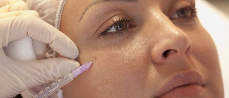 Мезотерапия для лица