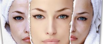 Кожа после пилинга