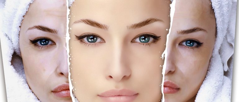 Кожа после пилинга