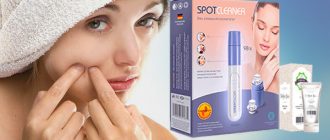 Spot Cleaner – отзывы на вакуумный очиститель пор