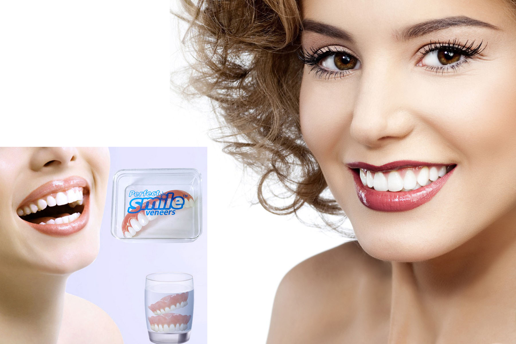 Perfect Smile Veneers