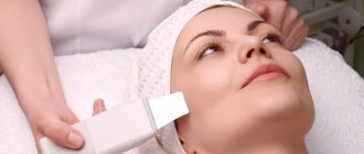 Что такое химическая чистка лица