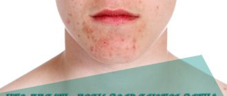 Что делать, если на коже начали появляться шелушащиеся пятна