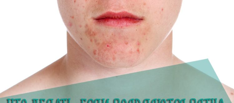 Что делать, если на коже начали появляться шелушащиеся пятна