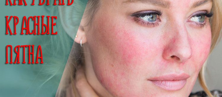 Что делать если появилось красное пятно на коже, которое чешется и шелушится