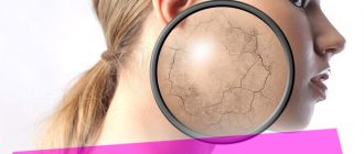 Что делать, если шелушится кожа – полезные советы от специалистов