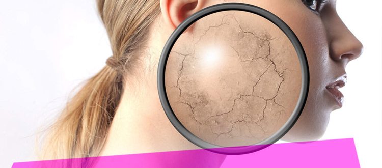 Что делать, если шелушится кожа – полезные советы от специалистов