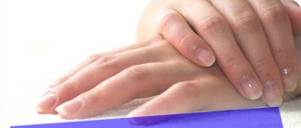 Что нужно делать если кожа на руках шелушится и облазит – советы от врачей