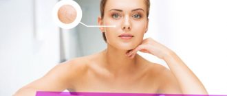 Что нужно делать, если кожа сухая и шелушится - рекомендации от косметологов