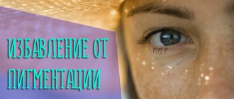 Избавление от пигментации на лице с помощью аптечных и домашних средств