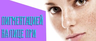 Как бороться с пигментацией на лице при беременности