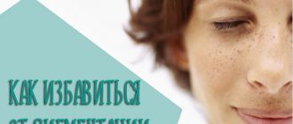 Как избавиться от пигментации на лице после родов с помощью домашних и аптечных средств