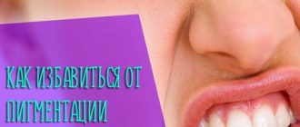 Как избавиться от пигментации на зубах у детей и взрослых