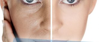 Как замаскировать поры на лице – полезные советы по уходу за проблемным лицом