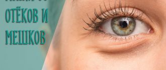 Лучшие маски от отёков и мешков под глазами в домашних условиях