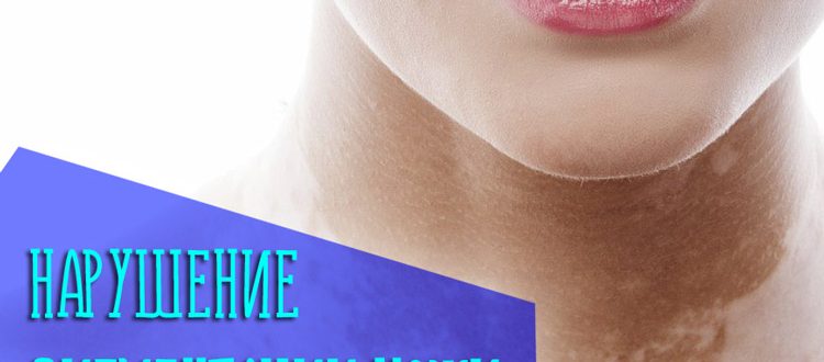 Нарушение пигментации кожи