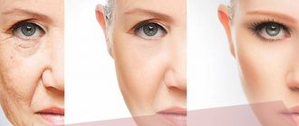 Плазменное омоложение лица – отзывы с фото до и после