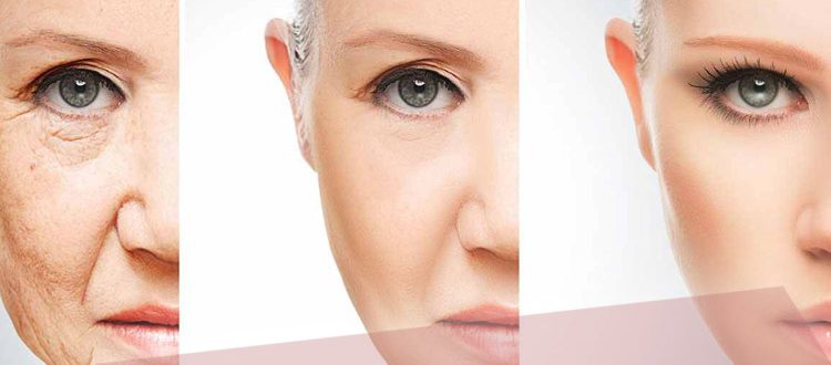 Плазменное омоложение лица – отзывы с фото до и после