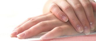 Почему кожа на пальцах рук трескается и шелушится – причины и лечение недуга