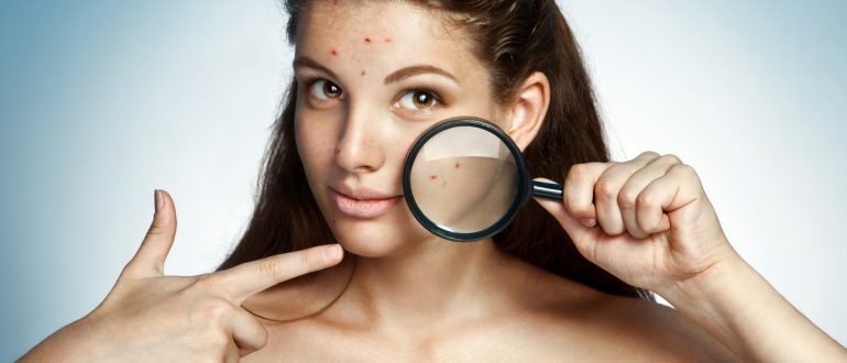 Проблемная кожа и причины её появления