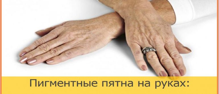 Причины пигментации кожи