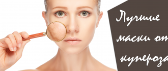 Лучшие рецепты масок от купероза на лице в домашних условиях