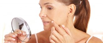 Причины появления носогубных складок