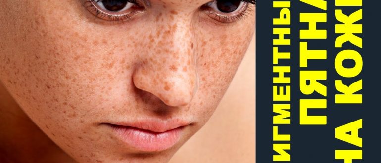 Нарушение пигментации