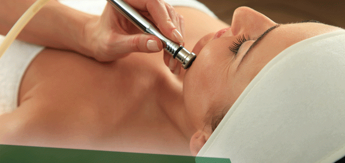 Алмазная чистка лица - фото до и после