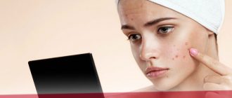 Чистка лица для подростков - рекомендации косметологов