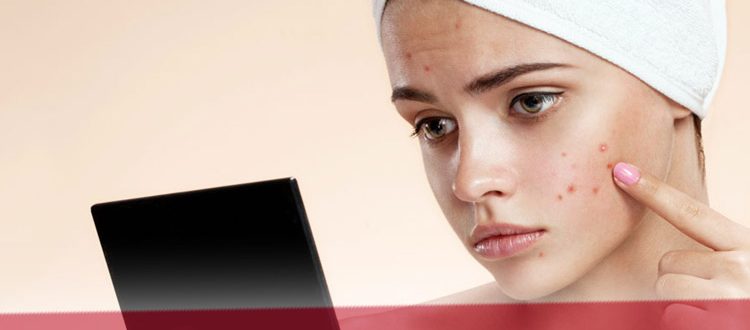 Чистка лица для подростков - рекомендации косметологов