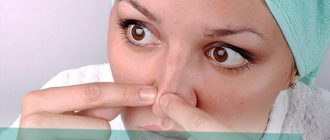 Чистка лица от черных точек в салоне - советы профессионалов